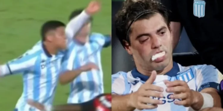 El tremendo codazo de Rojo a Sosa que genera gran preocupación en Racing